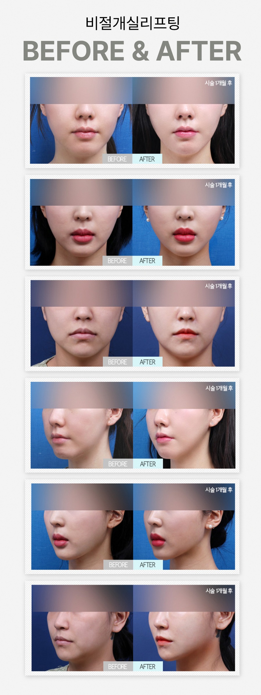 본문 내용을 보조하는 이미지