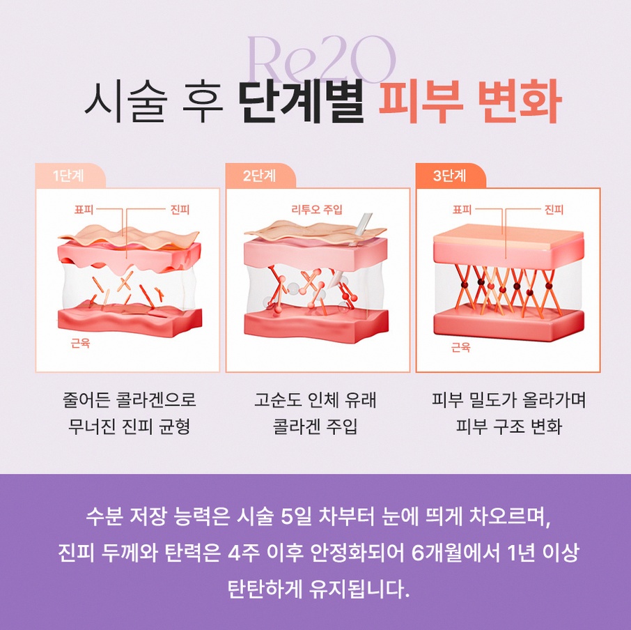 본문 내용을 보조하는 이미지