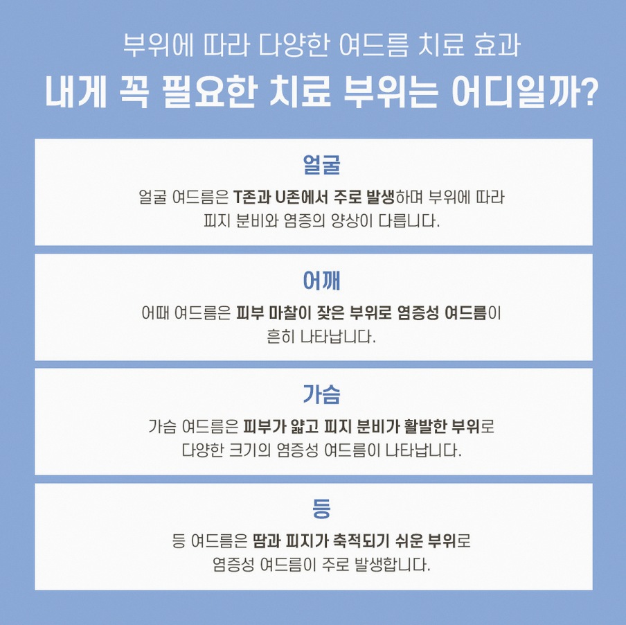 본문 내용을 보조하는 이미지