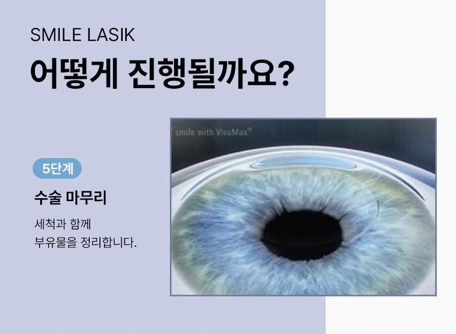 본문 내용을 보조하는 이미지