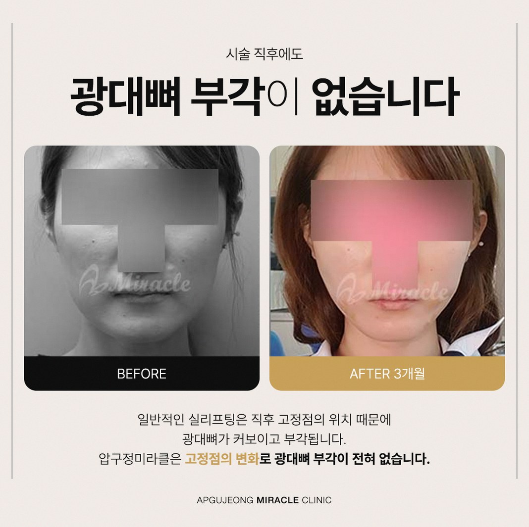 본문 내용을 보조하는 이미지