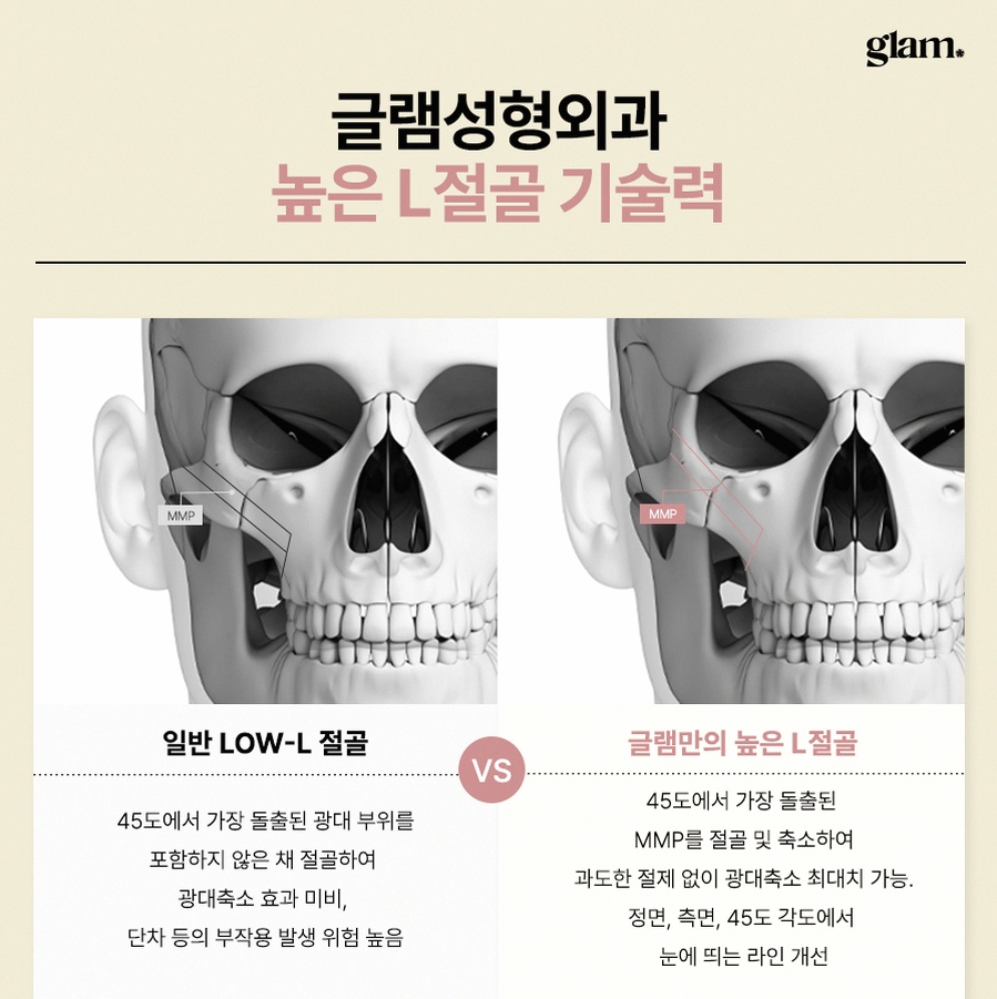본문 내용을 보조하는 이미지