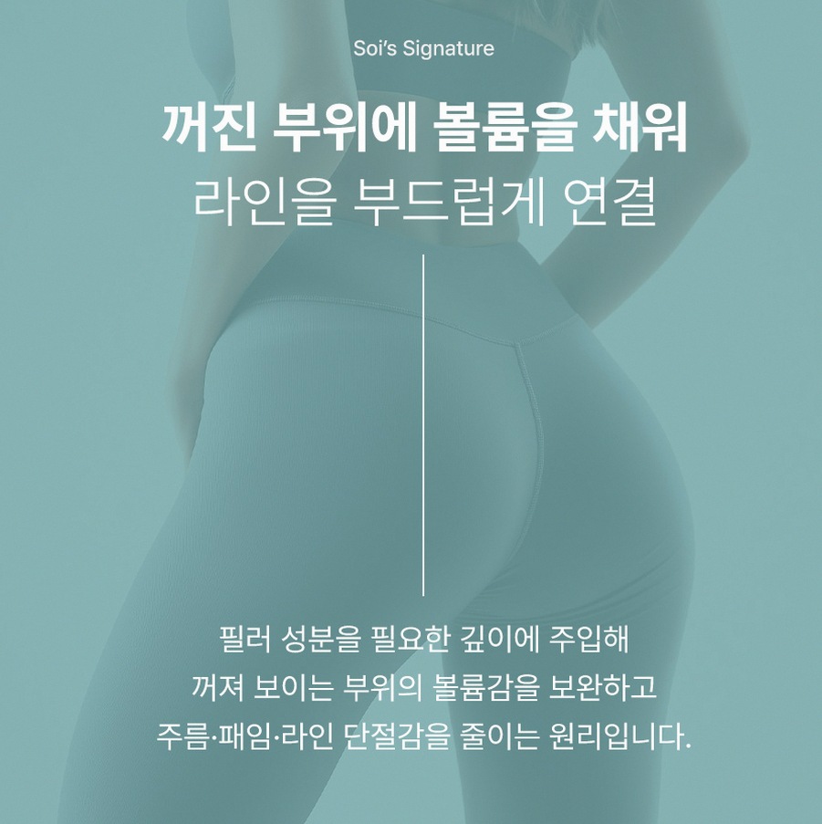본문 내용을 보조하는 이미지