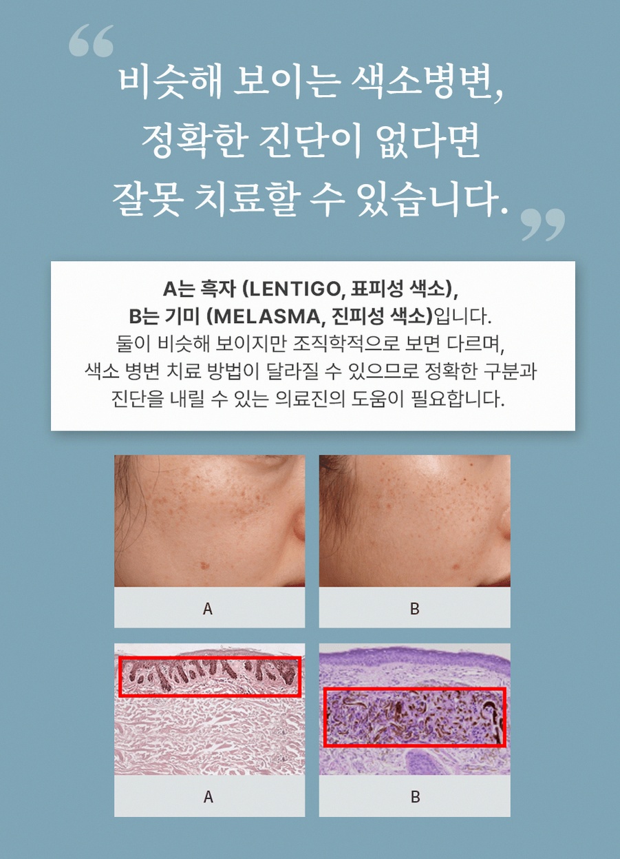 본문 내용을 보조하는 이미지