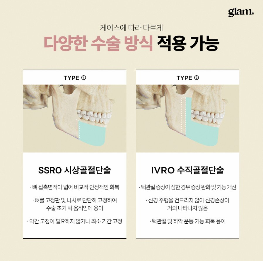 본문 내용을 보조하는 이미지