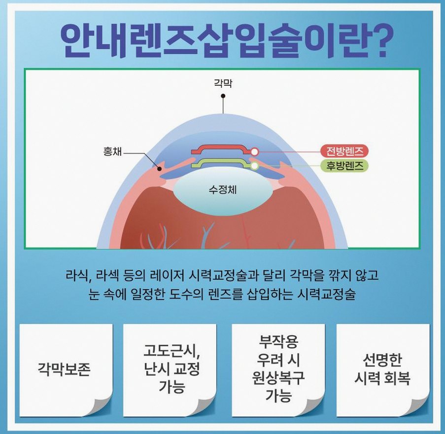 본문 내용을 보조하는 이미지