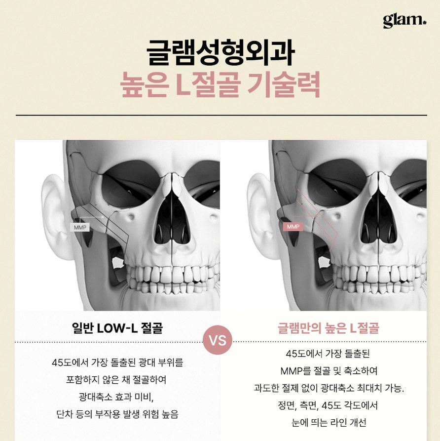 본문 내용을 보조하는 이미지