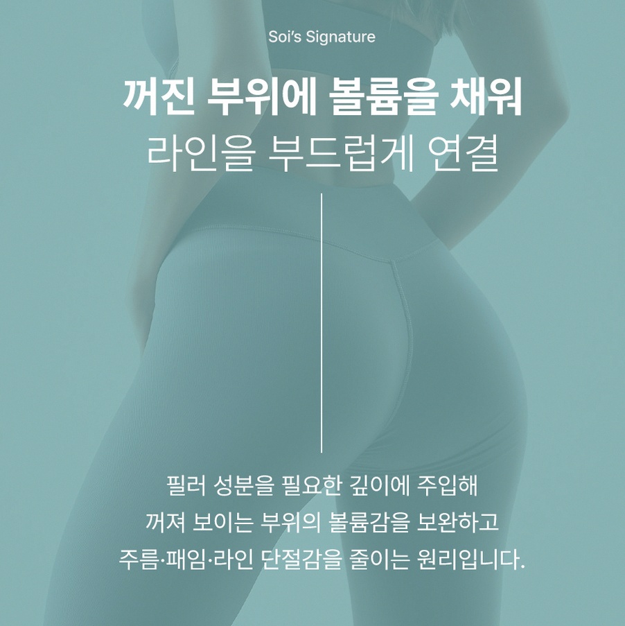 본문 내용을 보조하는 이미지