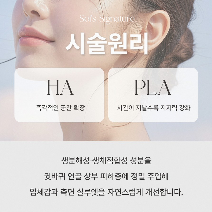 본문 내용을 보조하는 이미지