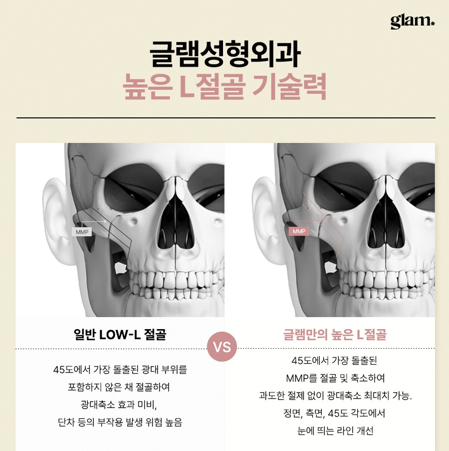 본문 내용을 보조하는 이미지