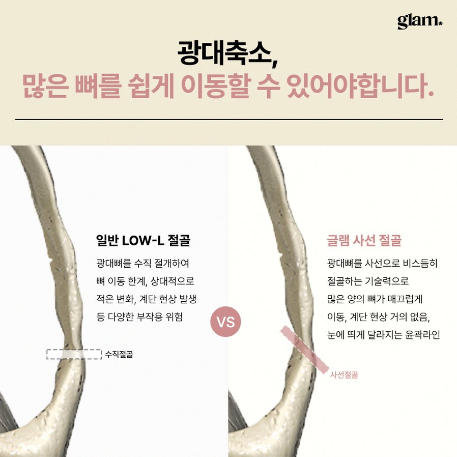 본문 내용을 보조하는 이미지