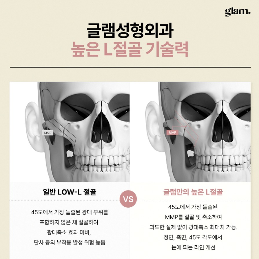 본문 내용을 보조하는 이미지