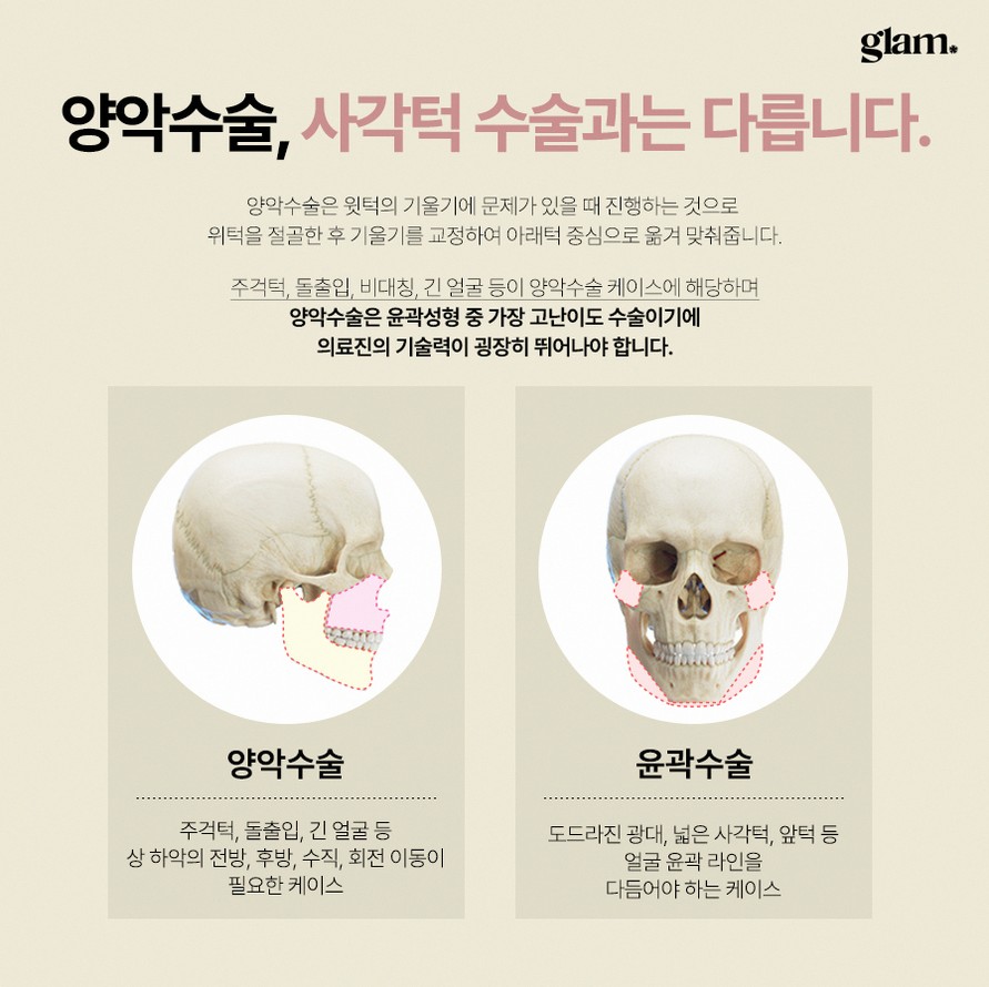 본문 내용을 보조하는 이미지