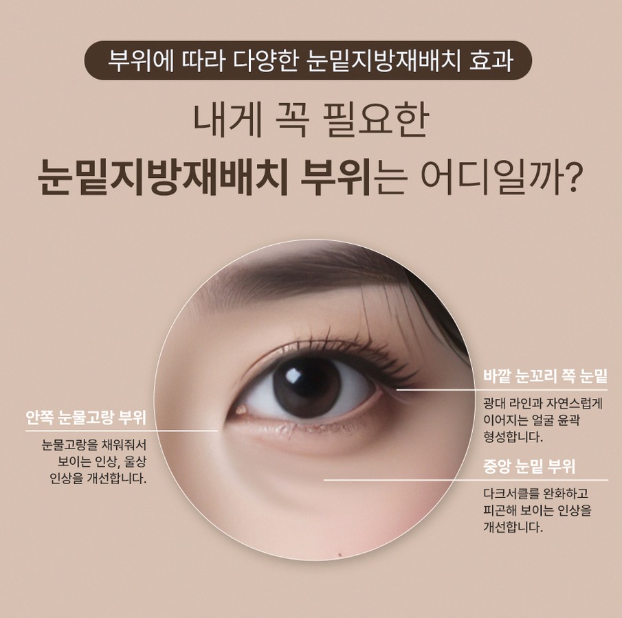 본문 내용을 보조하는 이미지