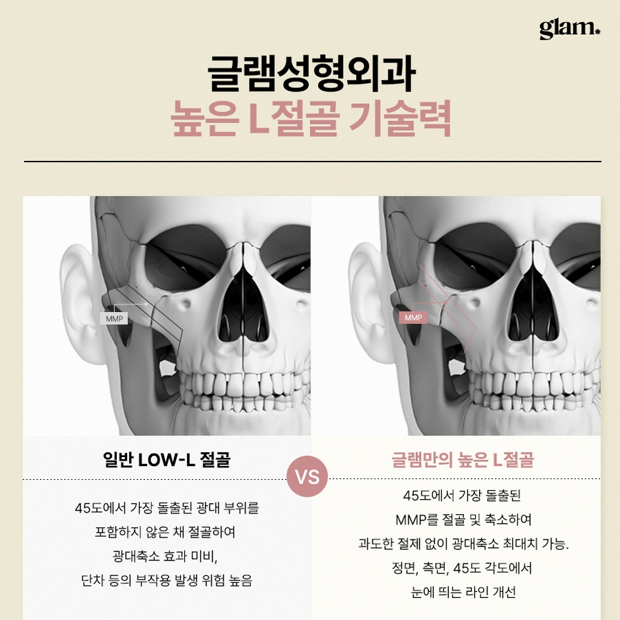본문 내용을 보조하는 이미지