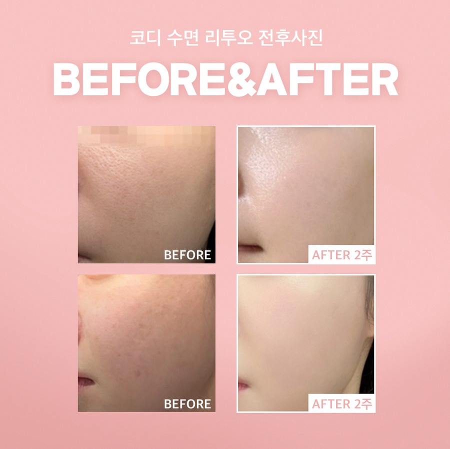 본문 내용을 보조하는 이미지