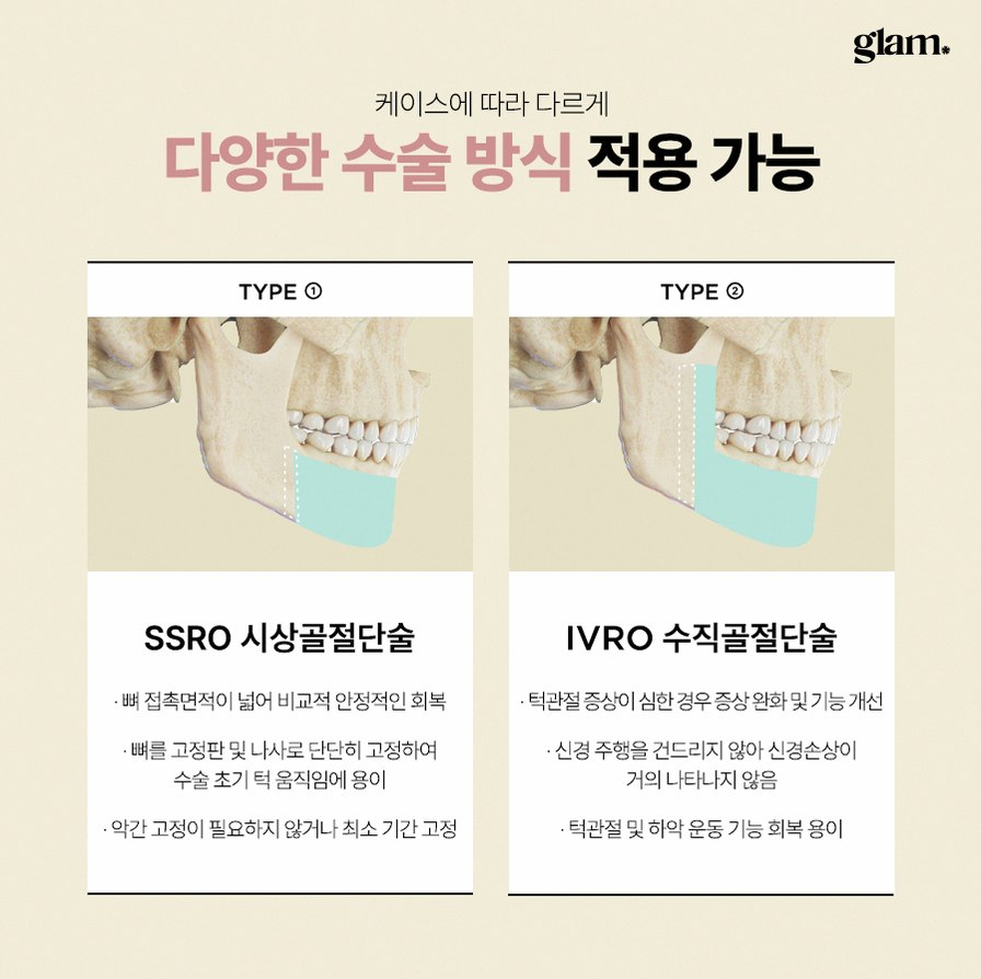 본문 내용을 보조하는 이미지